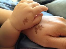 Baby-Birth-Marks