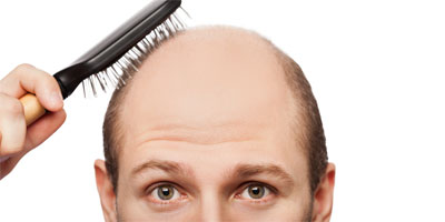 hair-loss-men