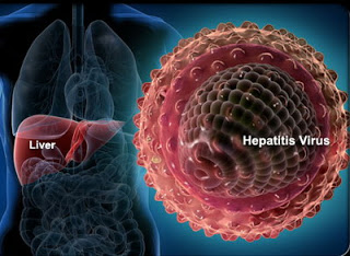 hepatitis