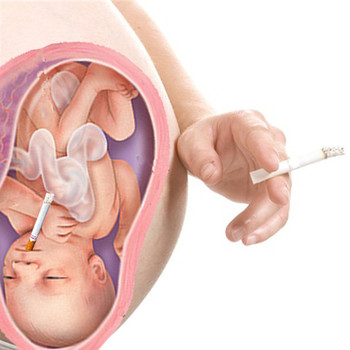 pregnancy-smoking