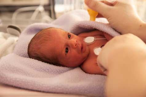 premature-baby