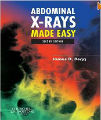 Abdominal X-Rays Made Easy, 2nd Ed