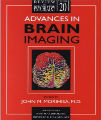 Advances in Brain Imaging, 1st Ed