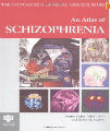 An Atlas of Schizophrenia