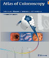 Atlas of Colonoscopy, 1st Ed