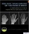 Skeletal Development of the Hand and Wrist, 1st ed 